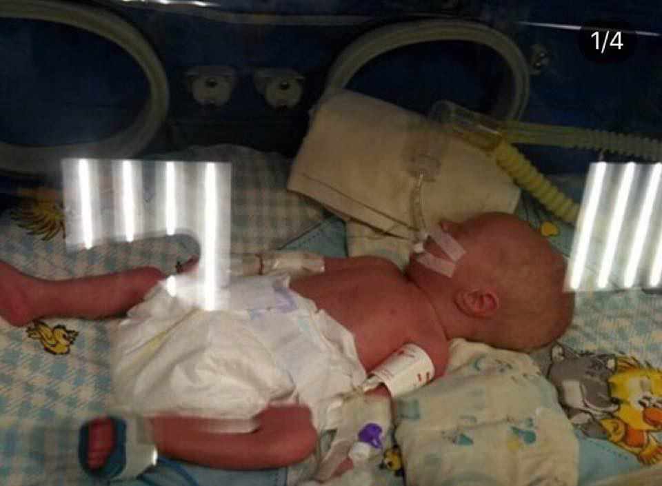 У Полтаві рятують життя близнят, від яких відмовилась мама: потрібна допомога