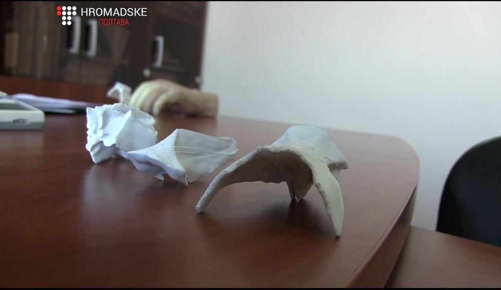 Полтавець навчився друкувати протези на 3D-принтері