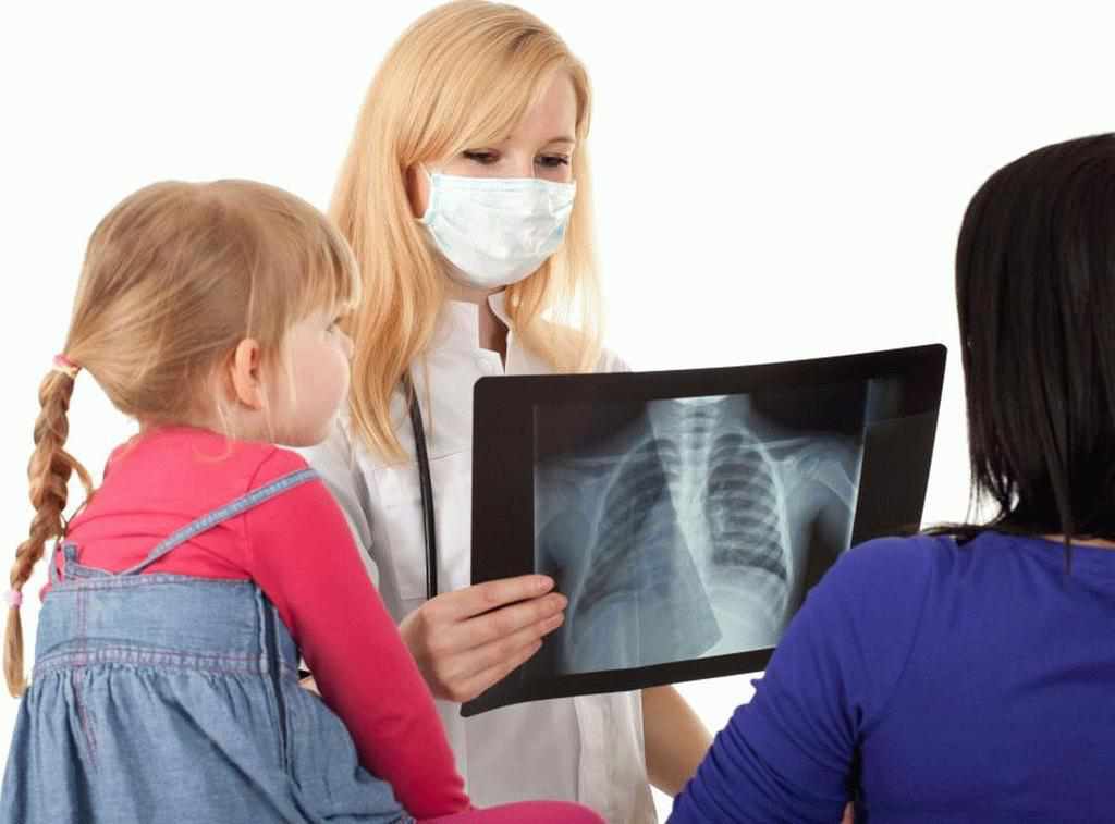 Діти і туберкульоз: де найбільше хворих на Полтавщині та що необхідно знати 