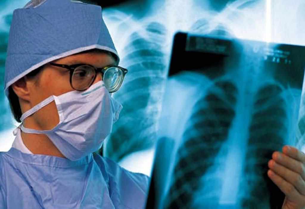  На туберкульоз захворіло 610 жителів Полтавської області