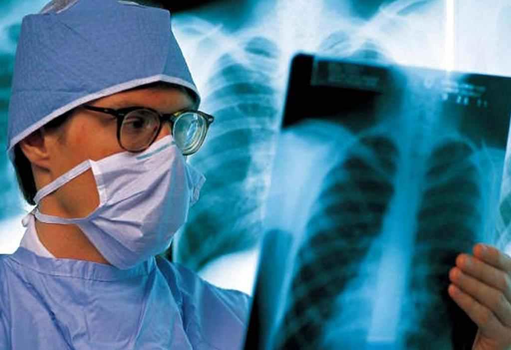 На туберкульоз захворіло 610 жителів Полтавської області