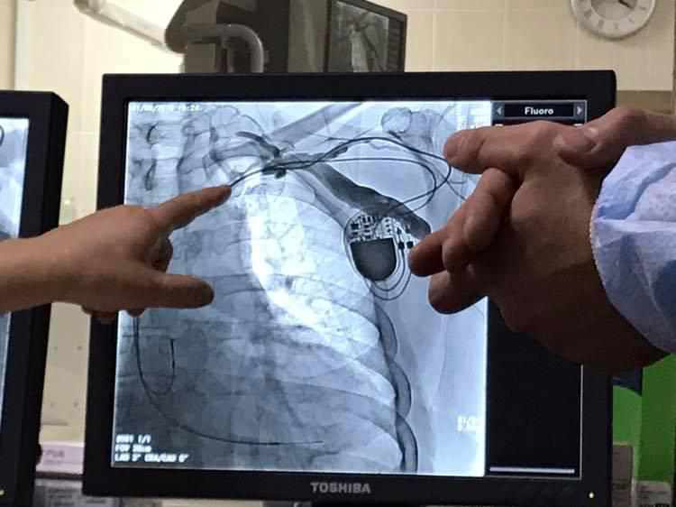 У Полтавській обласній лікарні чоловіку зробили унікальну операцію на серці. ФОТО