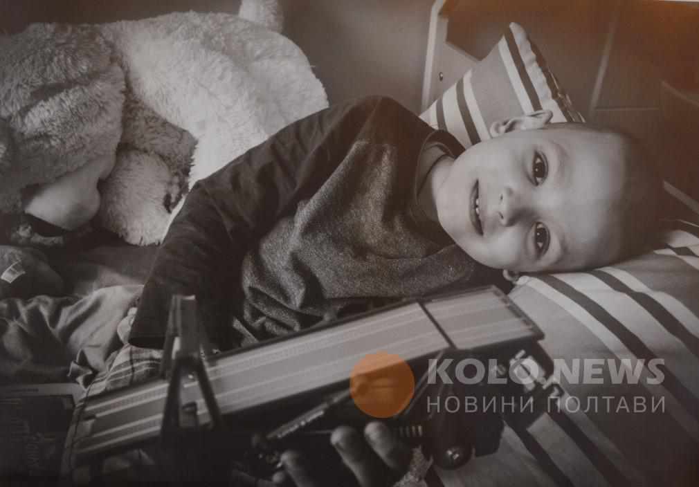 У Полтаві показали світлини онкохворих дітей, аби привернути увагу громадськості ФОТО