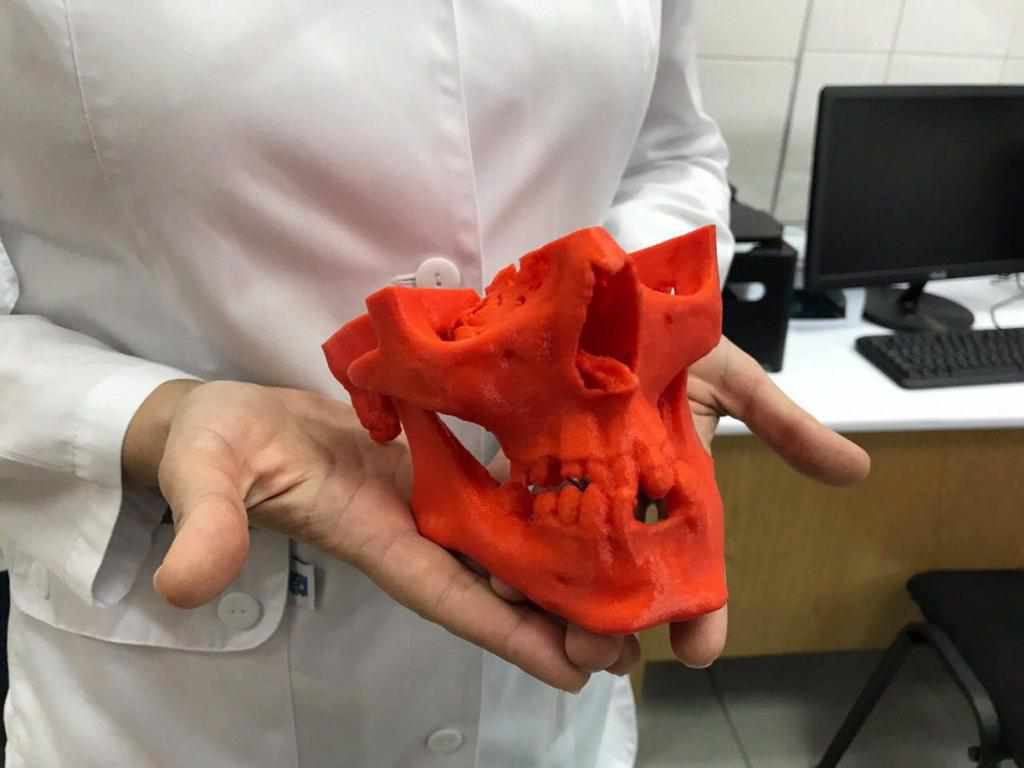 У київській клініці за допомогою 3D-друку реконструюватимуть лицеві кістки