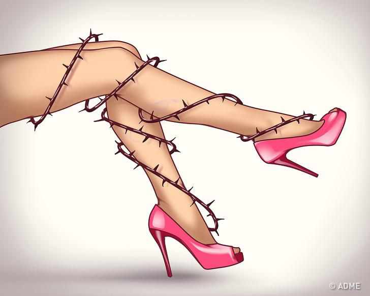 Як здолати варикоз і жити повноцінно без болю. ФОТО