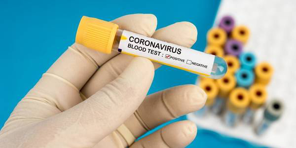 Тести на коронавірус: коли чекати в Полтаві та скільки коштуватимуть в аптеках