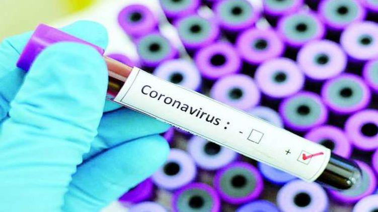 У Полтаві за кошти міського бюджету закуплять експрес-тести на виявлення коронавірусу: коли чекати