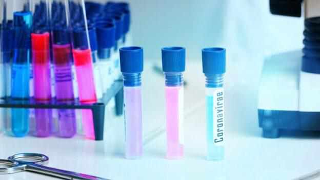 У МОЗ перевірили пасажирів літака, що прибув з Мілану: які результати тестів на коронавірус