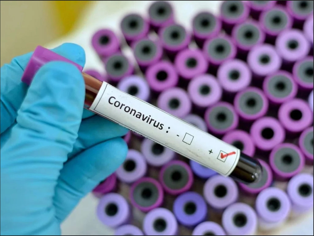 Кременчук отримав перші тести для виявлення коронавірусу