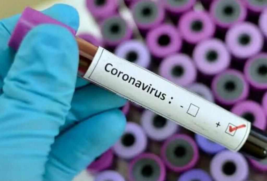 15 областей отримали тести для виявлення коронавірусу