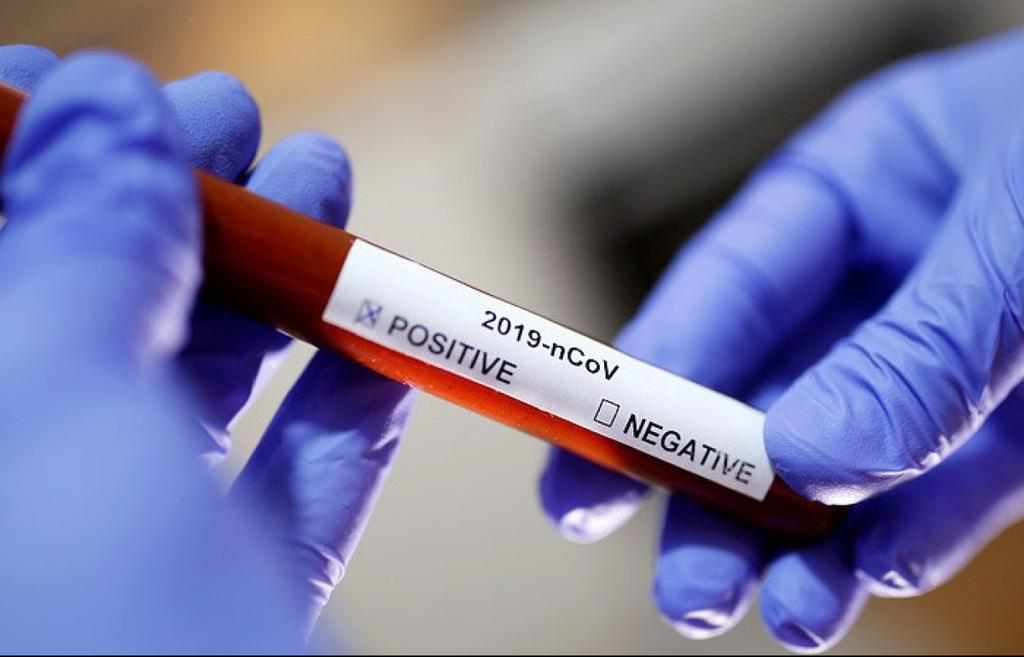 В Україні вже офіційно 7 випадків захворювання на коронавірус