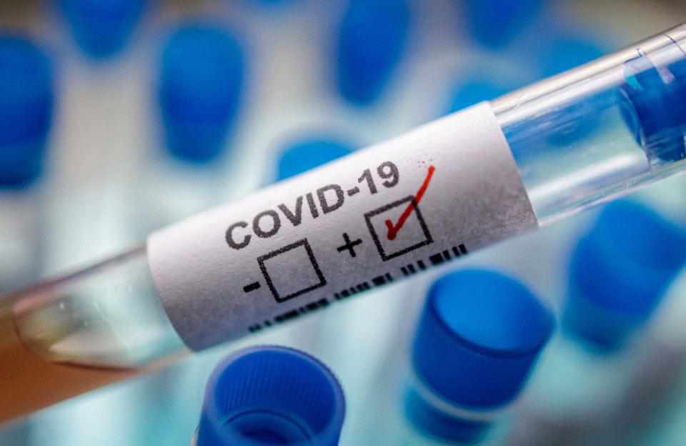 Міністр відзвітувався про 300% надбавки у медиків Полтавщини за лікування коронавірусу: як насправді
