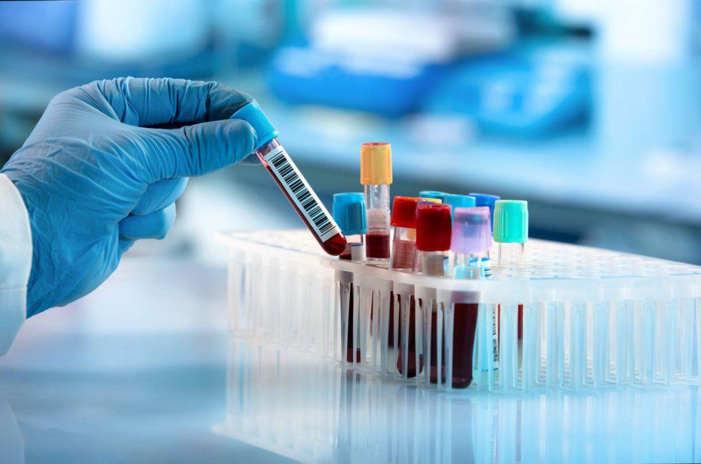 Кременчуцька лабораторія не отримала ліцензію і тому не може робити тести на коронавірус, – ДОЗ