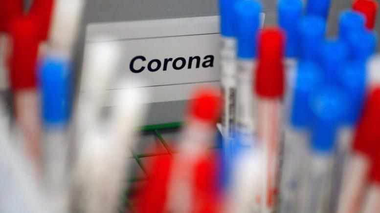 У Кременчуці розпочинають масове тестування на антитіла до коронавірусу, Полтава ще готується 