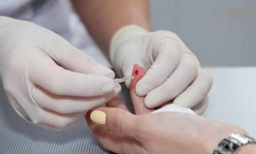 Полтавців безкоштовно перевірять на гепатит