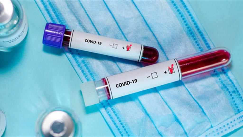 Минулої доби на Полтавщині виявили 24 хворих на коронавірус: де нові випадки