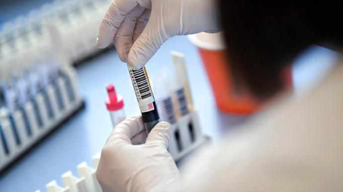 На Полтавщині 22 нові випадки захворювання на коронавірус, дві людини померли