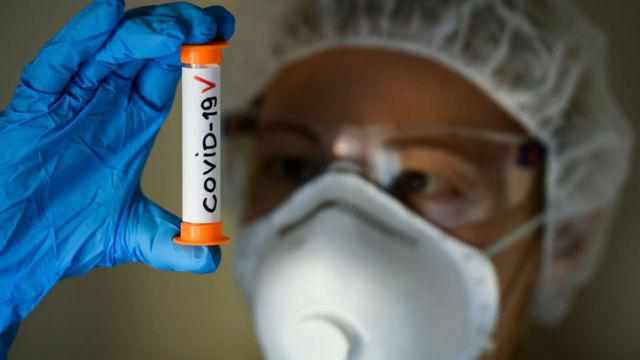 На Полтавщині за минулу добу виявили 56 нових випадків COVID-19, троє померло