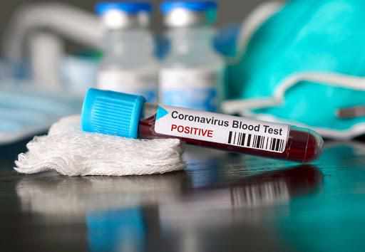 На Полтавщині підтвердили 182 нових випадків корнавірусу: ще двоє людей померли