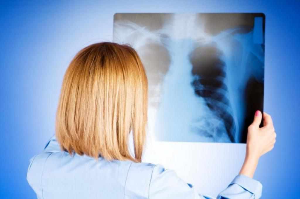 На Полтавщині стали більше хворіти на пневмонію, а до апаратів ШВЛ підключені майже 30 людей