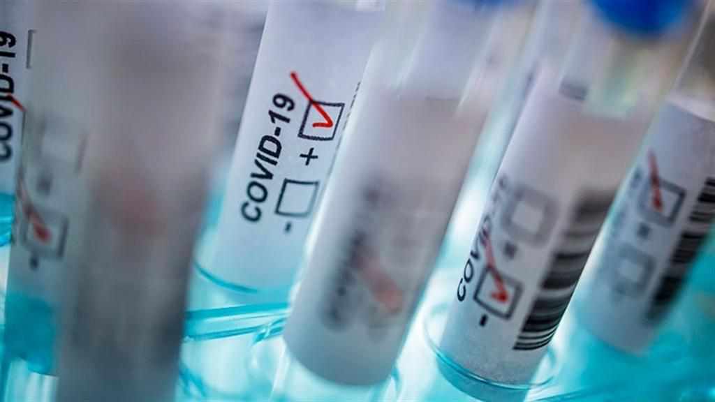 На Полтавщині за добу виявили більше пів тисячі нових випадків коронавірусу