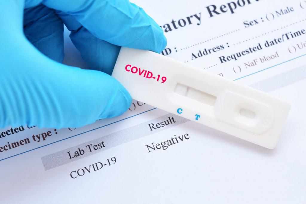 На Полтавщині за добу виявили менше 200 нових випадків захворюванння на COVID-19