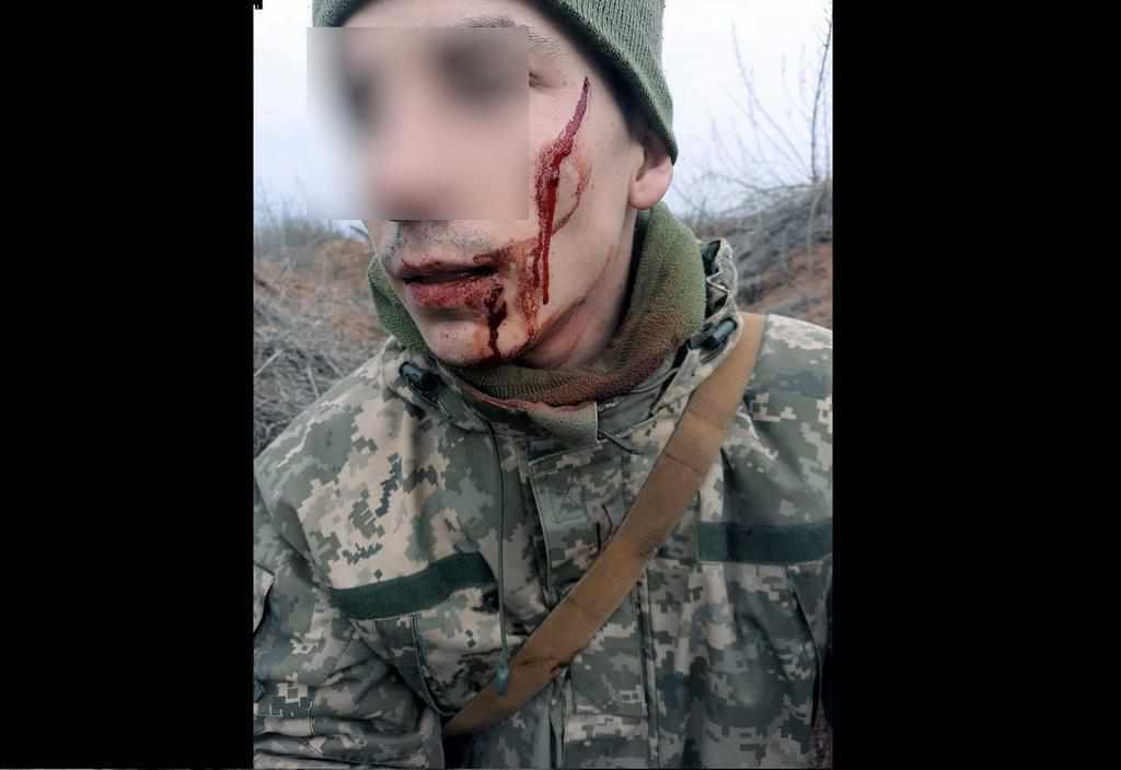 На одній із позицій Об’єднаних сил військовий затримав бойовика: бійця представлять до нагороди. ФОТО