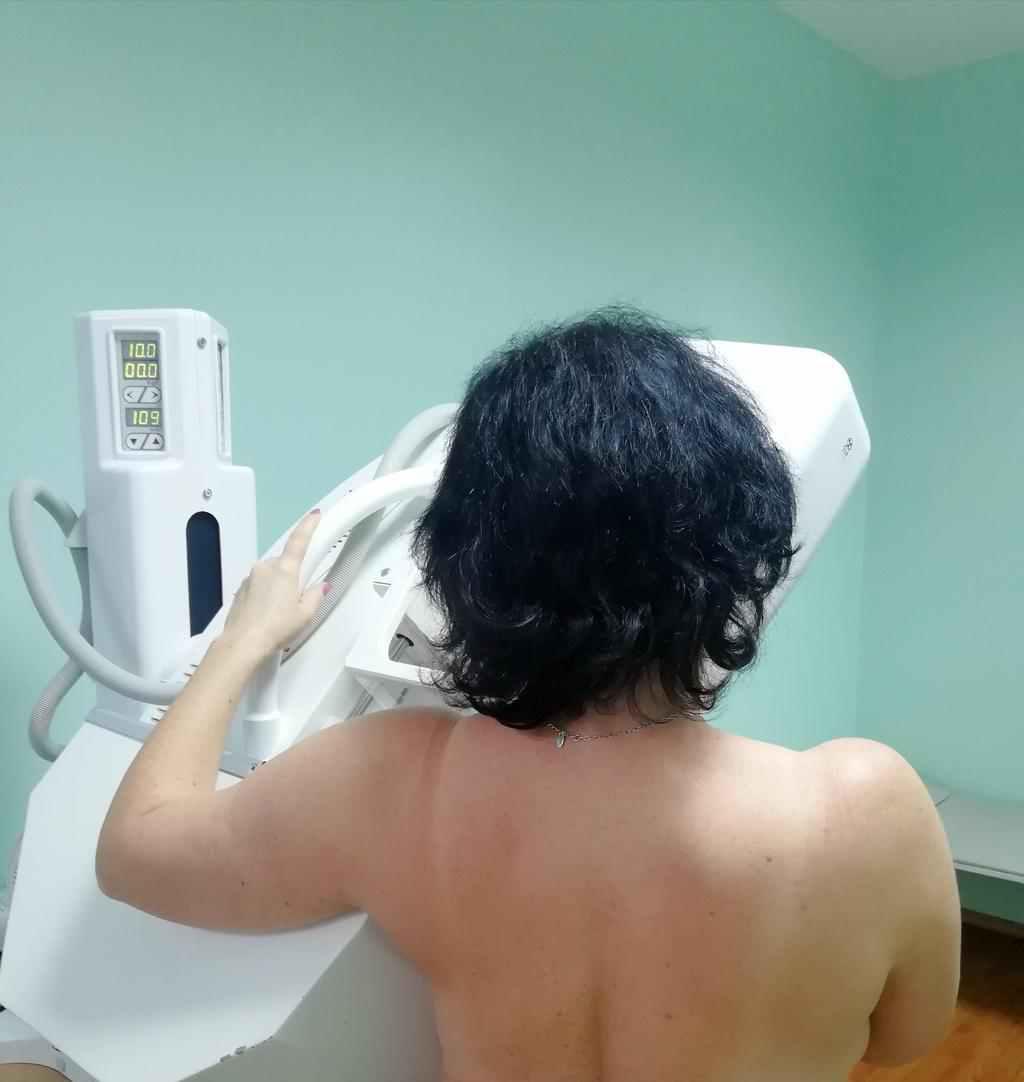 Жінок запрошують перевірити груди безкоштовно: як пройти мамографію у Полтаві