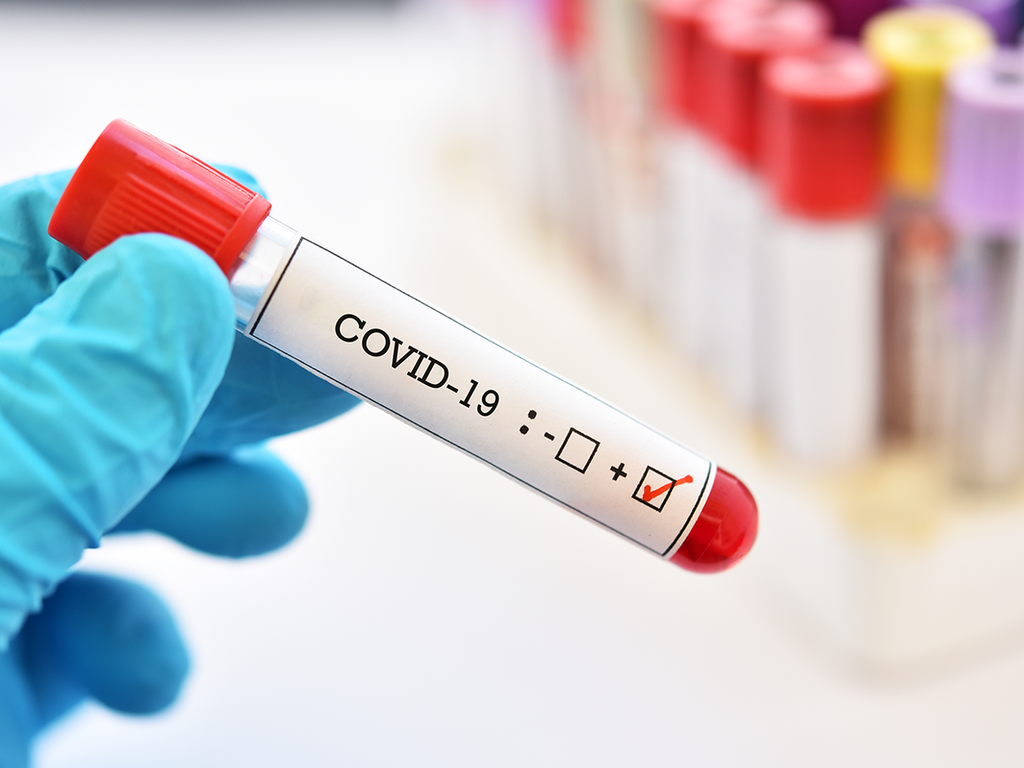 Кількість померлих від коронавірусу на Полтавщині – тисяча