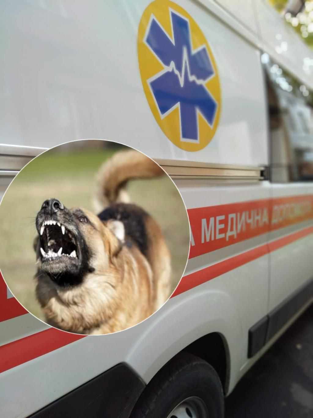 На Полтавщині лікарку покусав собака у дворі пацієнтів під час виклику