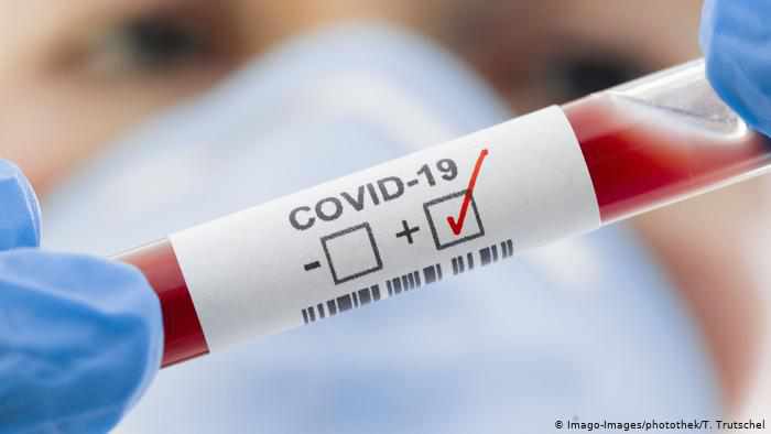 На Полтавщині 900 нових випадків COVID-19, 21 пацієнт помер