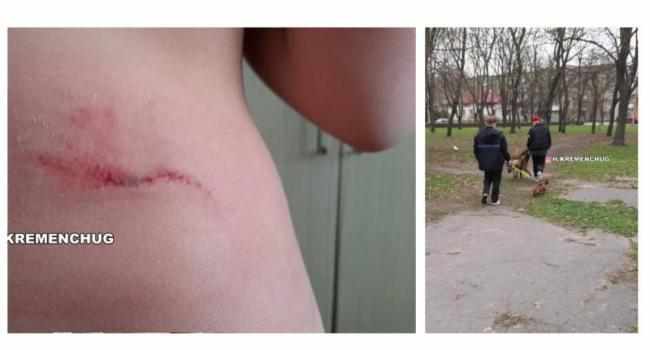 Собака напав на дитину в парку, власник утік з місця події – випадок на Полтавщині