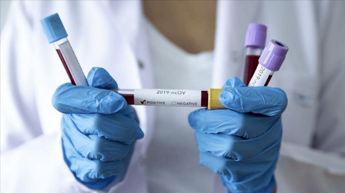 За минулу добу від коронавірусу на Полтавщині померла одна людина, одужали – 47