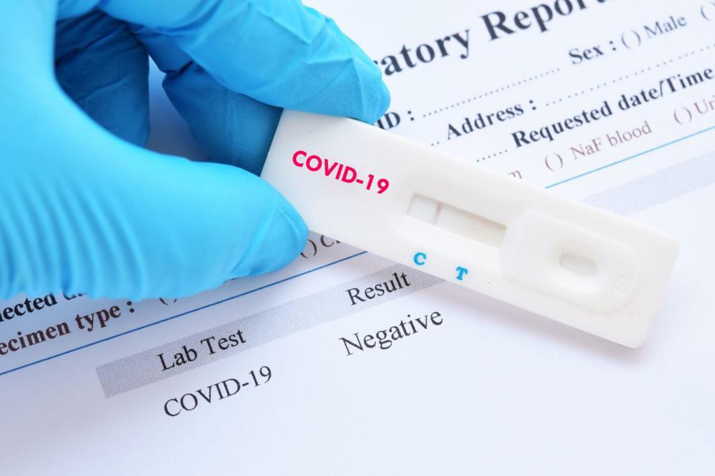 61 новий випадок COVID-19 на Полтавщині, зафіксували ще 4 смерті