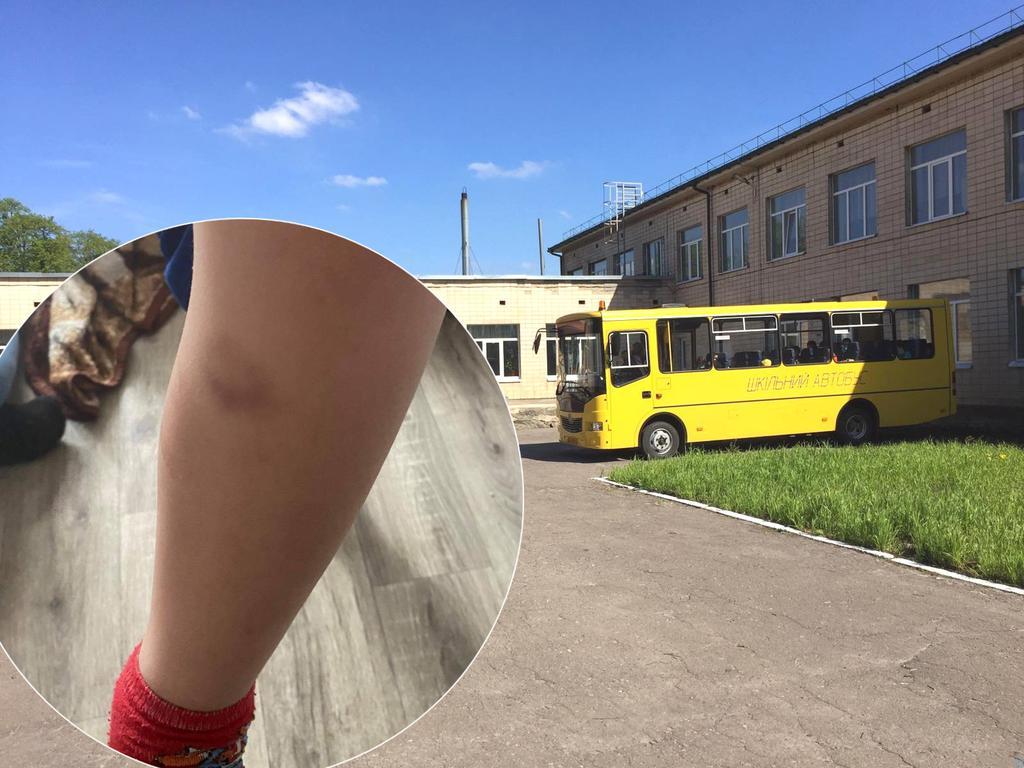 У ліцей під Полтавою викликали поліцію та швидку допомогу: учень намагався стрибнути у вікно. ФОТО, ВІДЕО