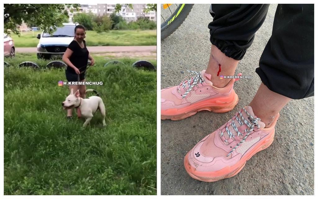 У Кременчуці собака напав на дівчину-підлітка. ФОТО