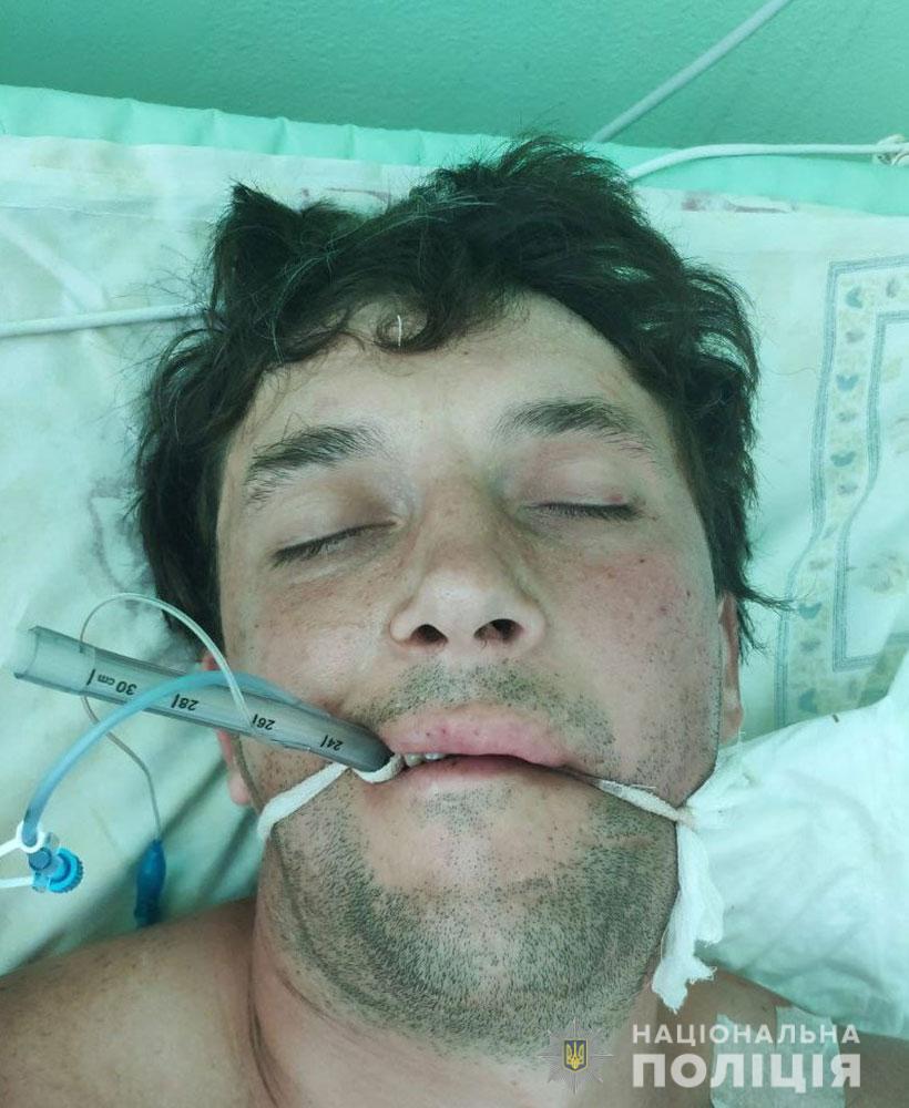 Впав зі сцени на полі Марусі Чурай: допоможіть встановити особу чоловіка