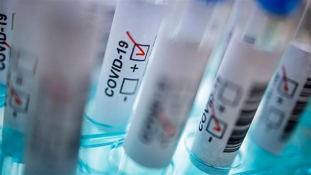 Майже сотня нових випадків і одна смерть: поширення коронавірусу на Полтавщині