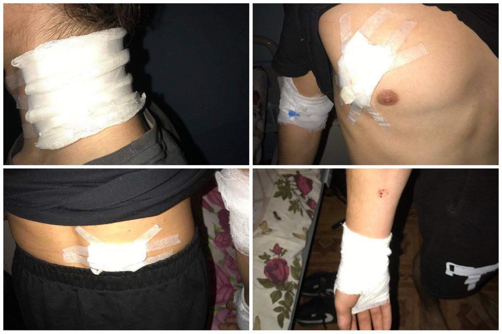 У Полтаві стріляли у дворі будинку: поранили двох дітей. ФОТО