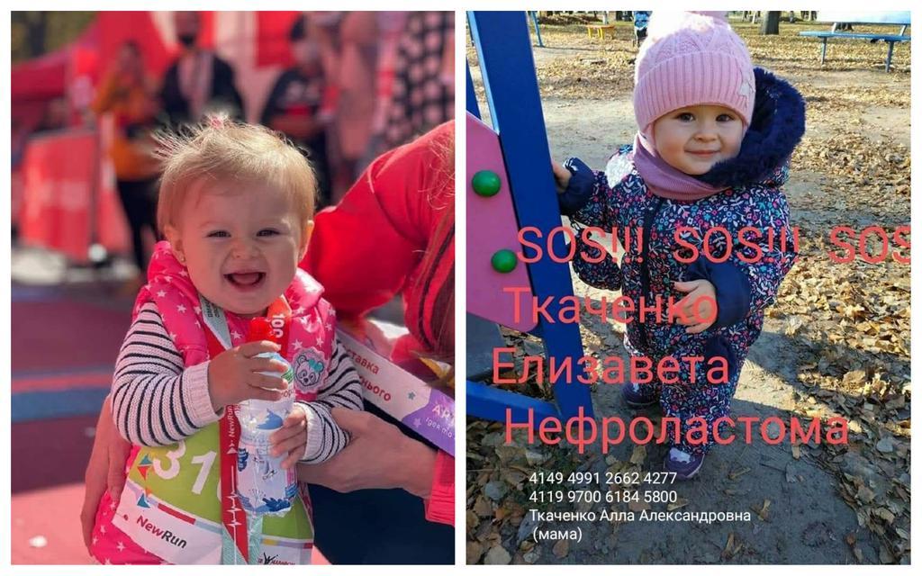 В однорічної полтавки виявили пухлину: рідні благають про допомогу