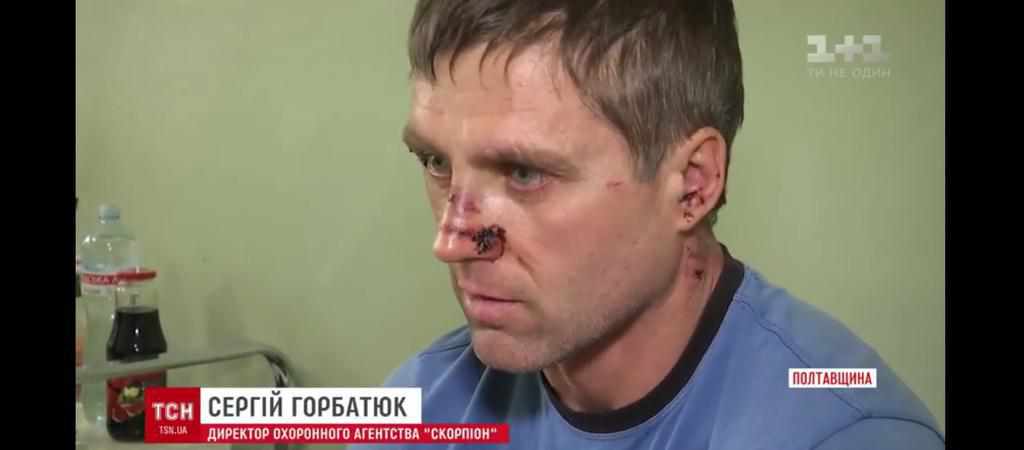 Арсен Аваков: Кременчуцькому «Скорпіону – 2016», що влаштував бійню в Полтаві, анулювали ліцензію