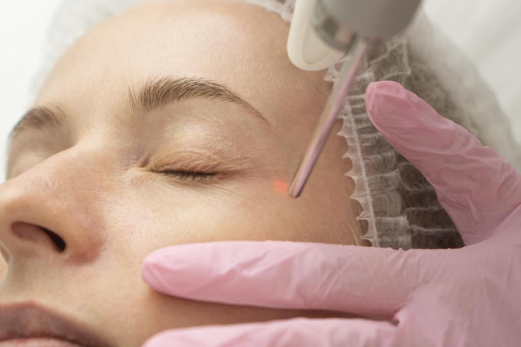 Лазерне омолодження у Києві