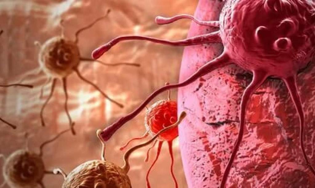 Як рання діагностика раку може врятувати ваше життя?