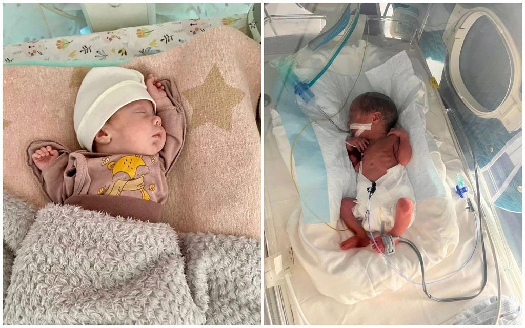 У Полтавському перинатальному центрі виходили малюка, який народився з вагою 900 грам