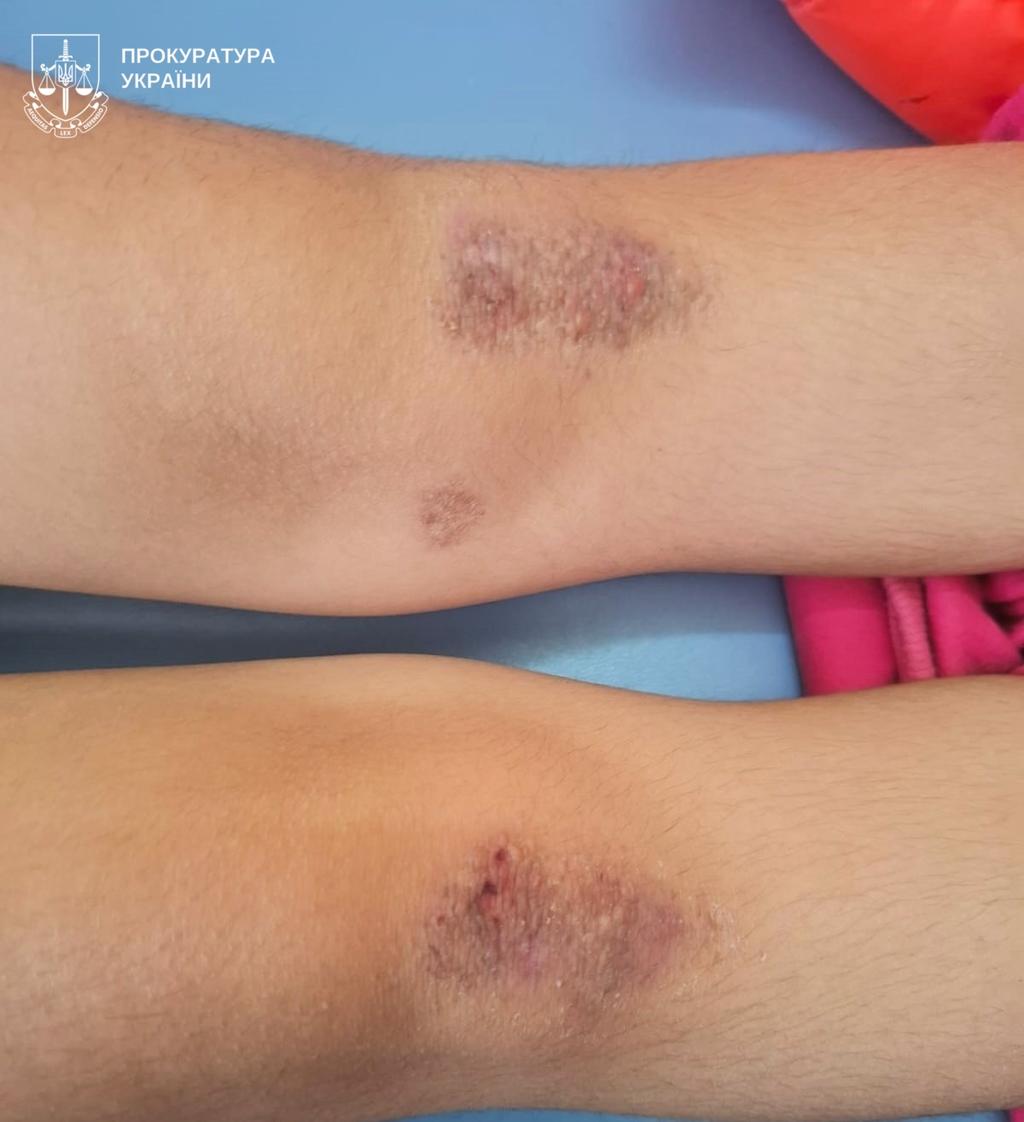 Дві доби на колінах і побиття: полтавку підозрюють у знущанні над сестрами