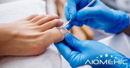 Нігтьовий грибок (оніхомікоз): чому не можна ігнорувати потемніння нігтя?