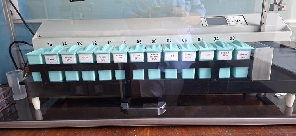 У Полтаві запрацювала нова станція для раннього виявлення раку