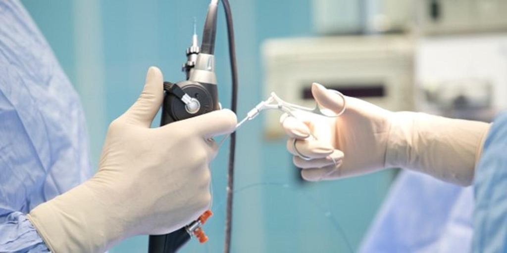 Колоноскопія під наркозом: що потрібно знати