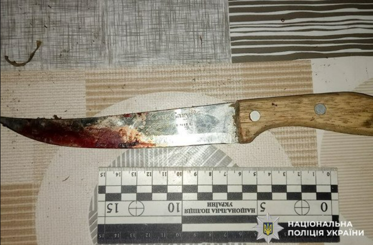 У Полтаві чоловік під час конфлікту відрізав жінці пальці