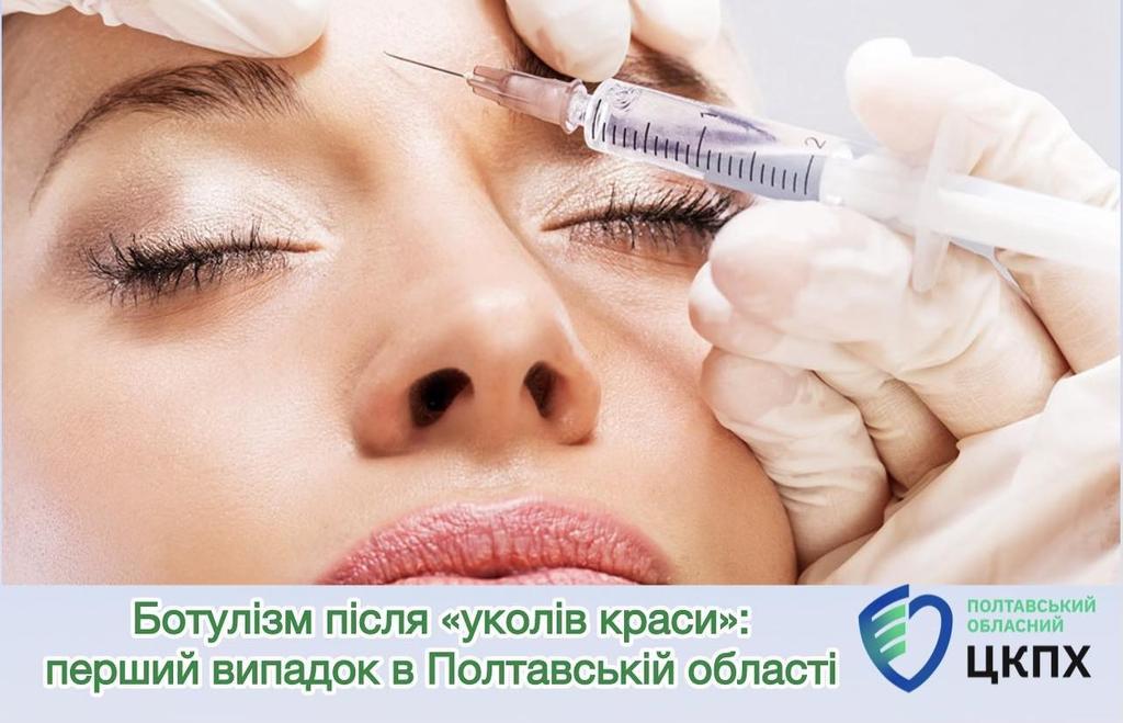 На Полтавщині жінка захворіла на ботулізм після «уколів краси»